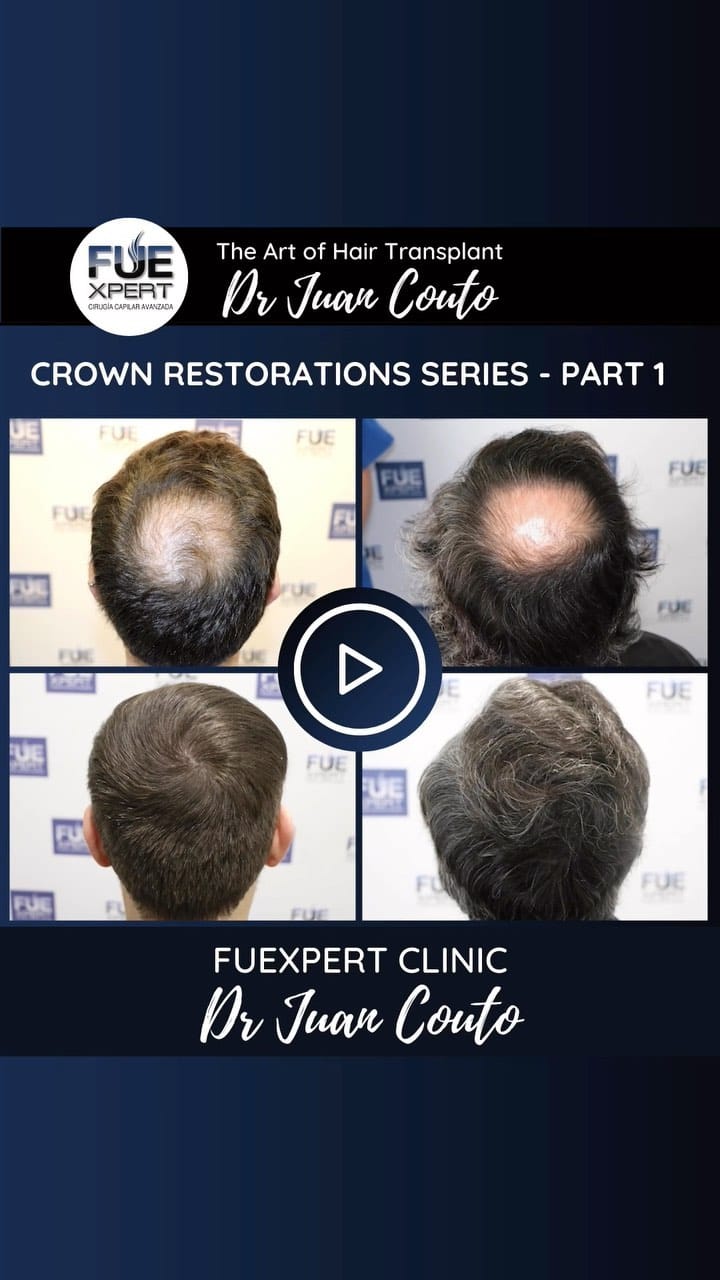 Post 10 by FUExpert Clinic on Instagram (video)