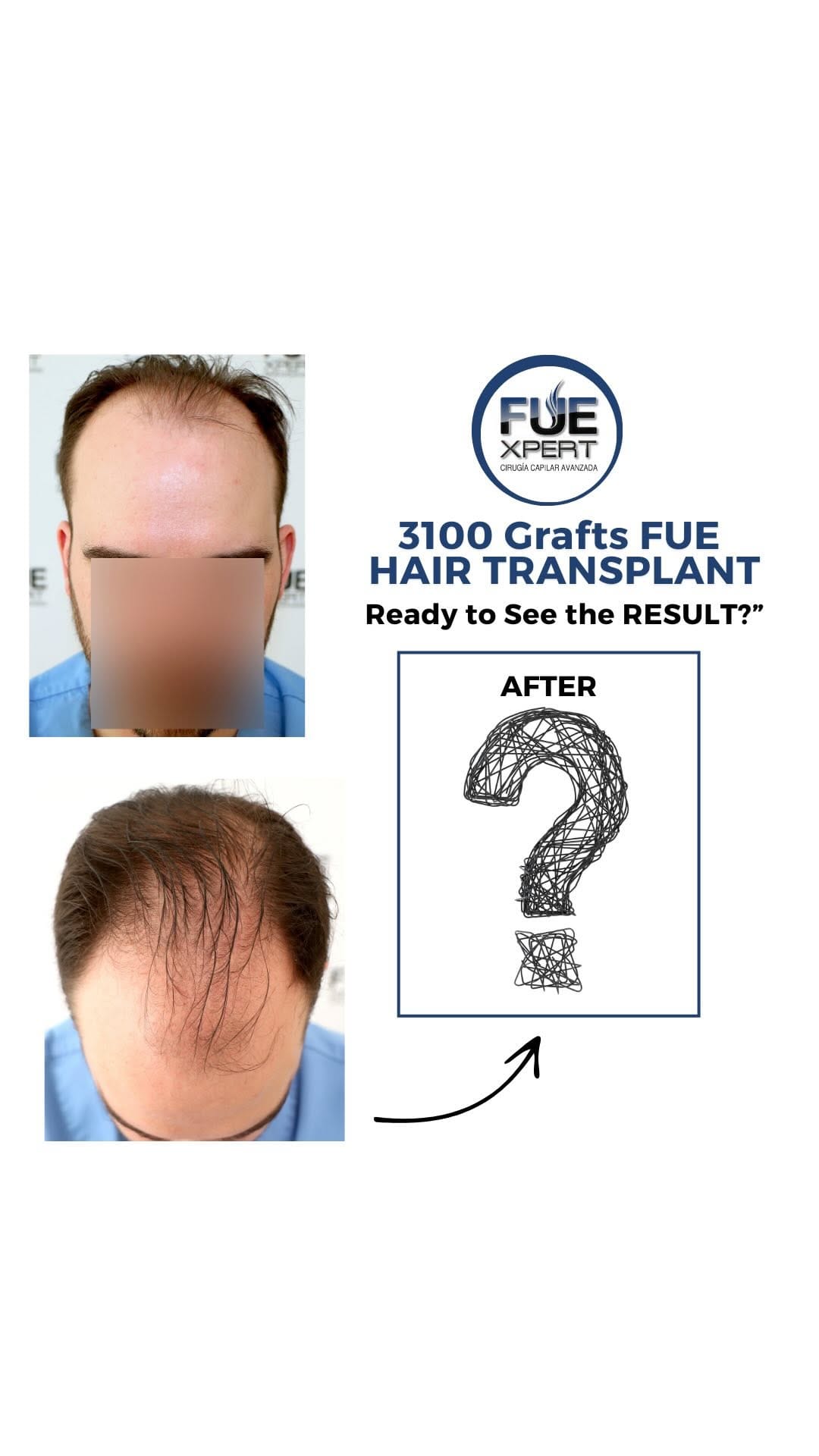 Post 9 by FUExpert Clinic on Instagram (video)