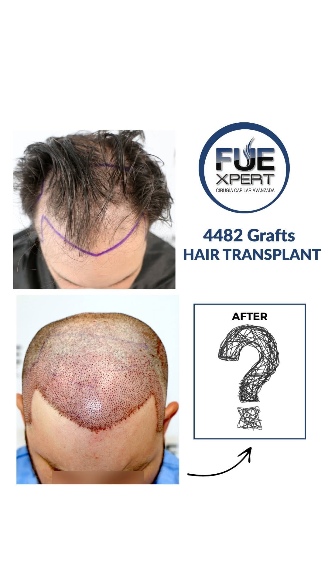 Post 4 by FUExpert Clinic on Instagram (video)