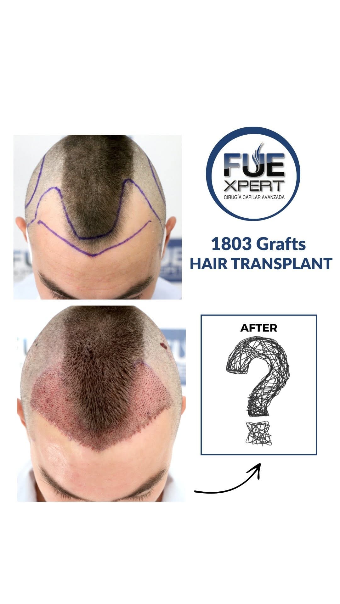 Post 2 by FUExpert Clinic on Instagram (video)