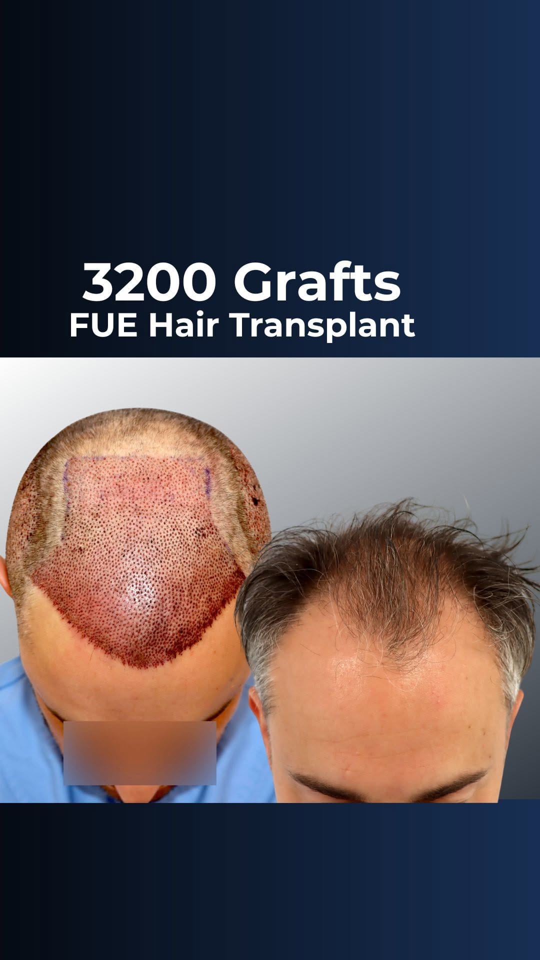 Post 5 by FUExpert Clinic on Instagram (video)