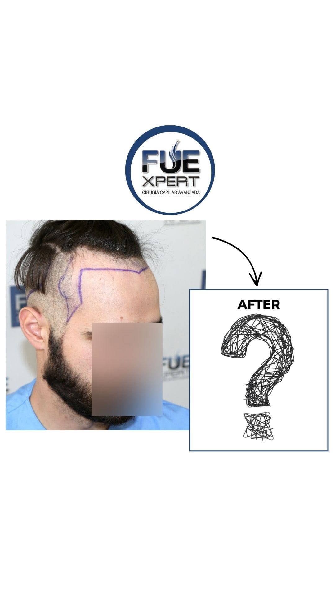 Post 7 by FUExpert Clinic on Instagram (video)