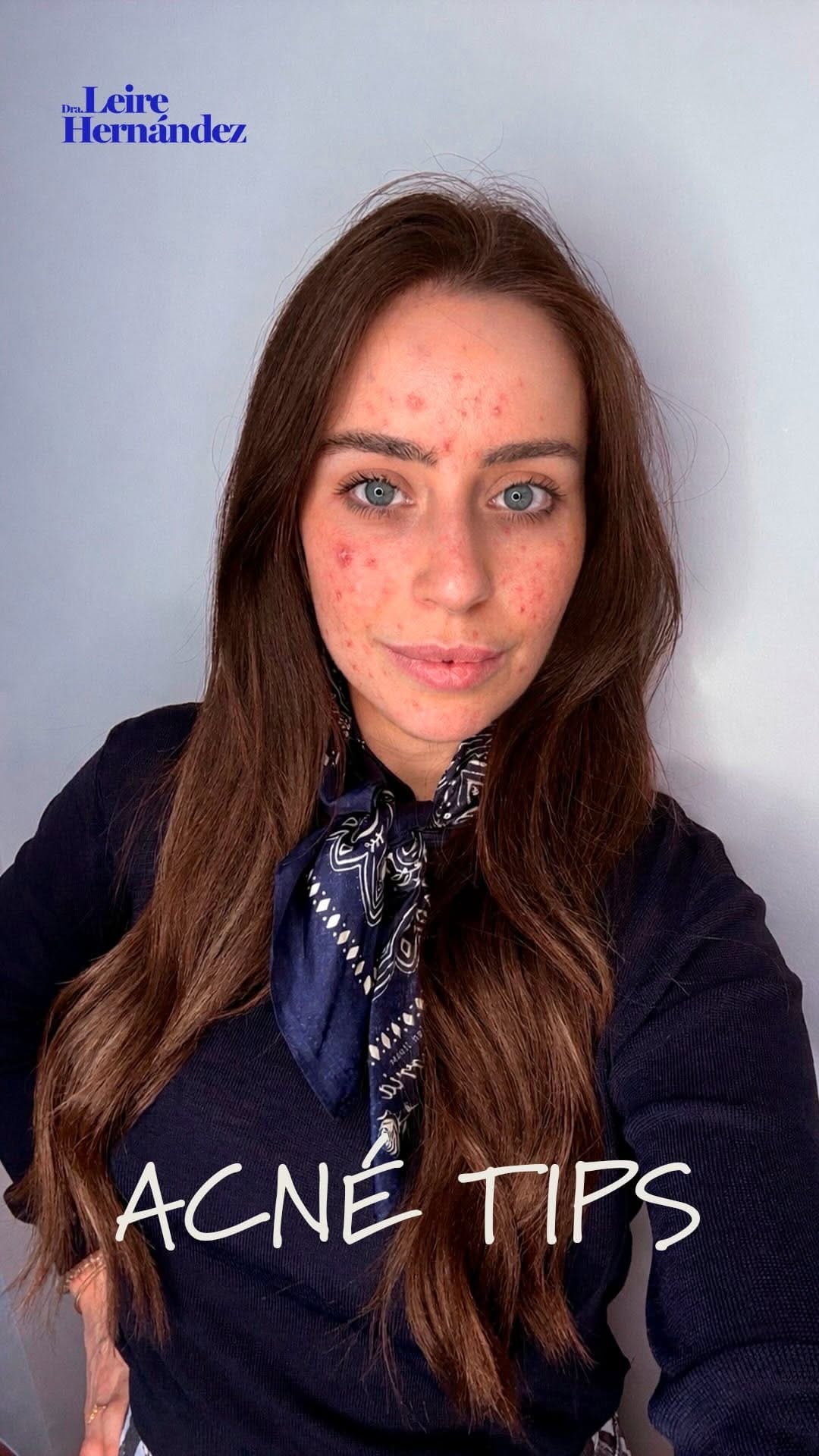 Post 2 by Leire Hernández | Medicina Estética on Instagram (video)