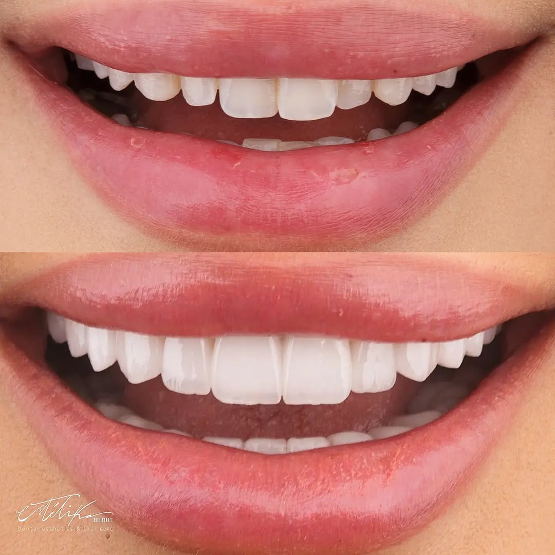 Post 8 by Dr. Khalil Sabbagh on Instagram (image)