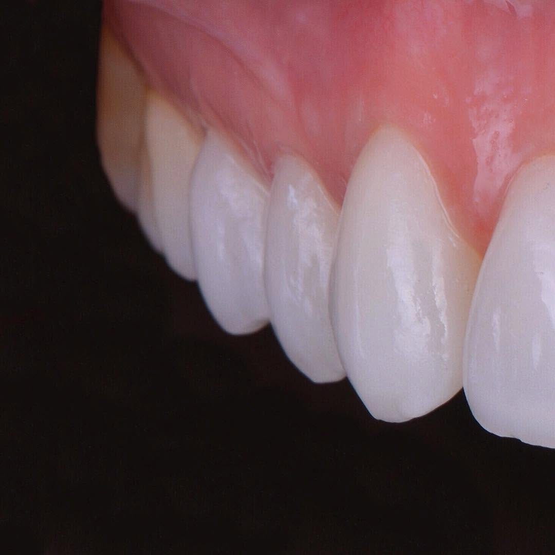 Post 5 by Prof. Dr. Miguel Merino Arends DDS.MSC on Instagram (image)