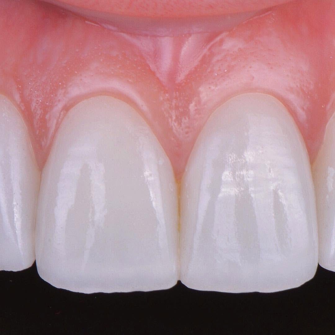 Post 6 by Prof. Dr. Miguel Merino Arends DDS.MSC on Instagram (image)