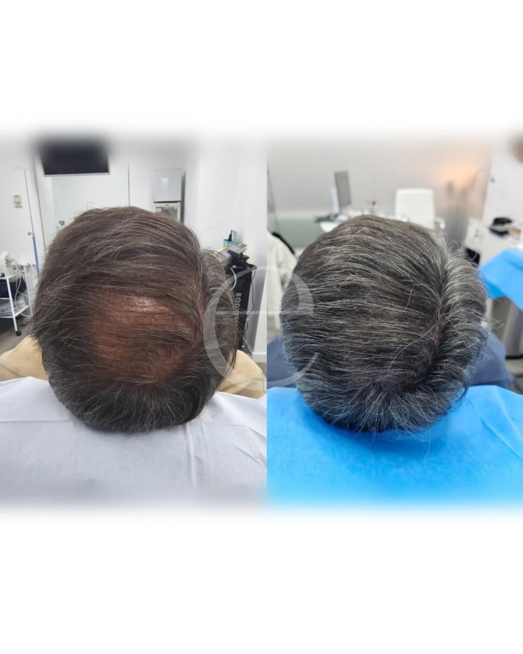 Post 3 by Dr. Amir Tarighpeyma on Instagram (carousel)