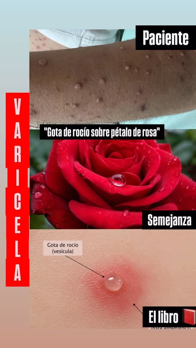 Post 5 by Dr. Albert Cova M | Pediatra Puericultor on Instagram (video)