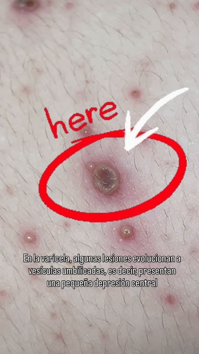 Post 6 by Dr. Albert Cova M | Pediatra Puericultor on Instagram (video)