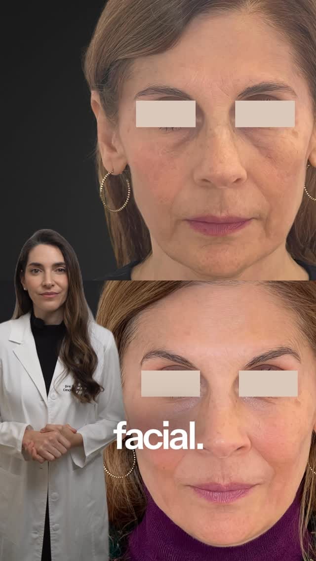 Post 8 by Dra. Victoria Prats | Cirujano Maxilofacial on Instagram (video)