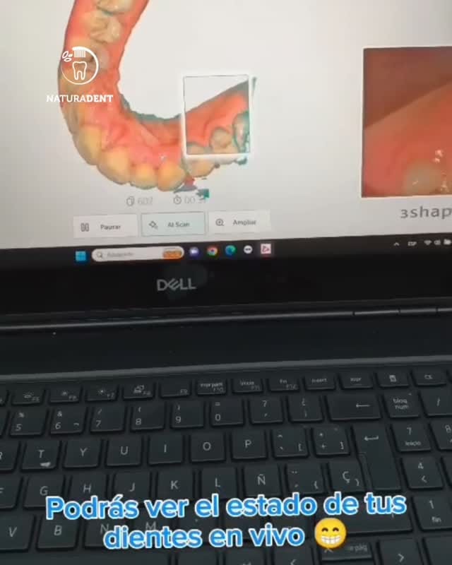 Post 4 by Clínicas Naturadent on Instagram (video)
