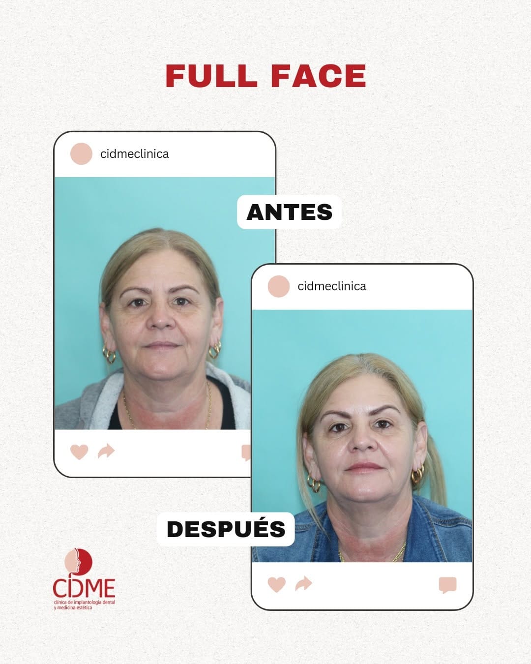 Post 5 by Clinica Cidme on Instagram (carousel)