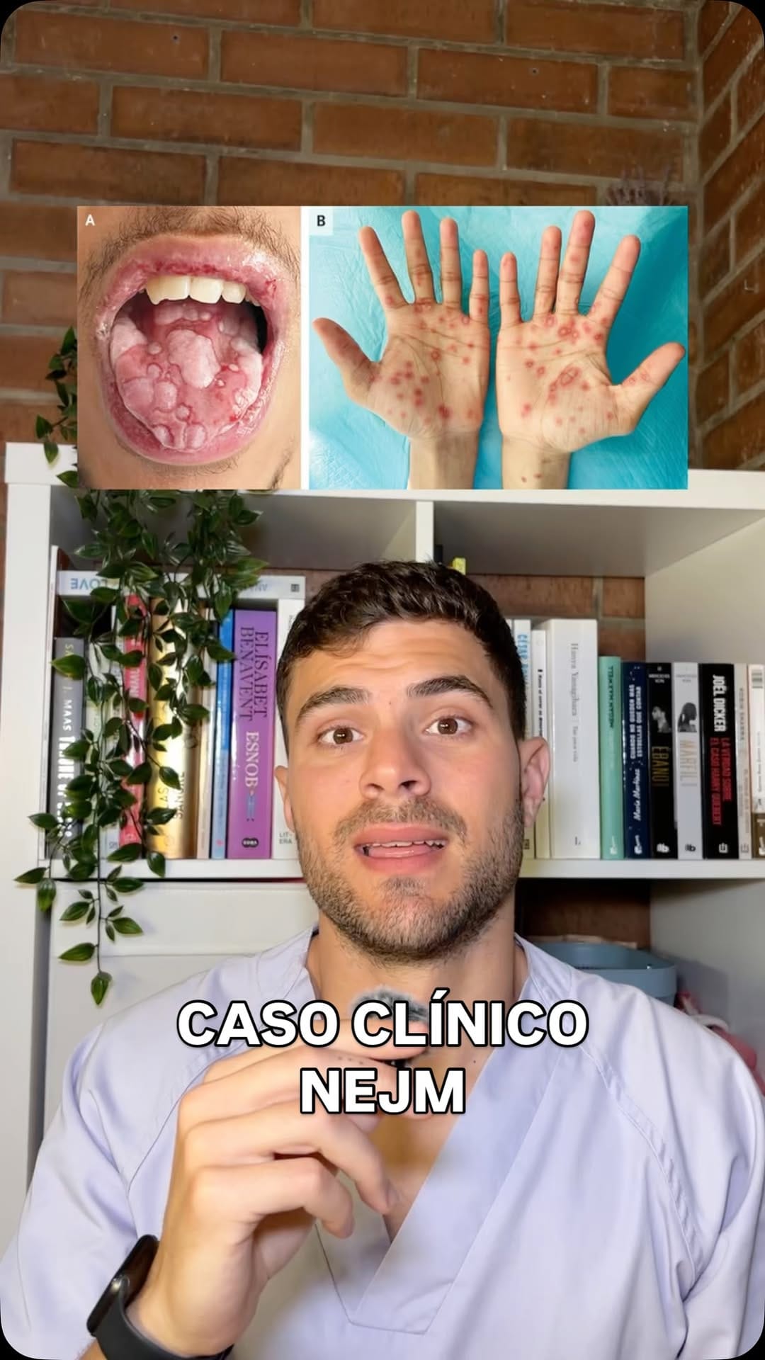 Post 1 by Dr. Víctor Espuig on Instagram (video)