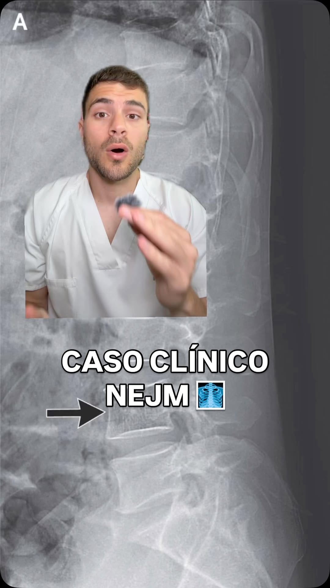 Post 8 by Dr. Víctor Espuig on Instagram (video)