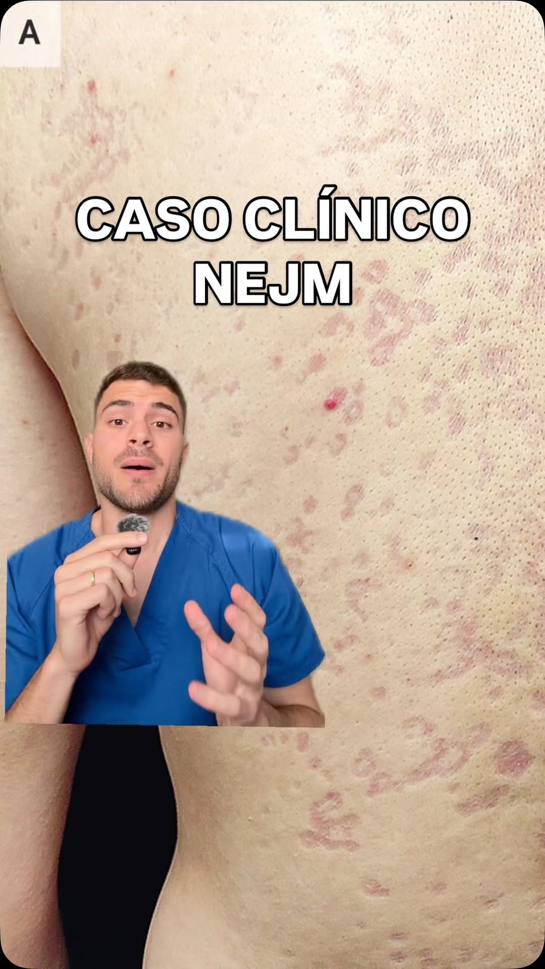 Post 5 by Dr. Víctor Espuig on Instagram (video)