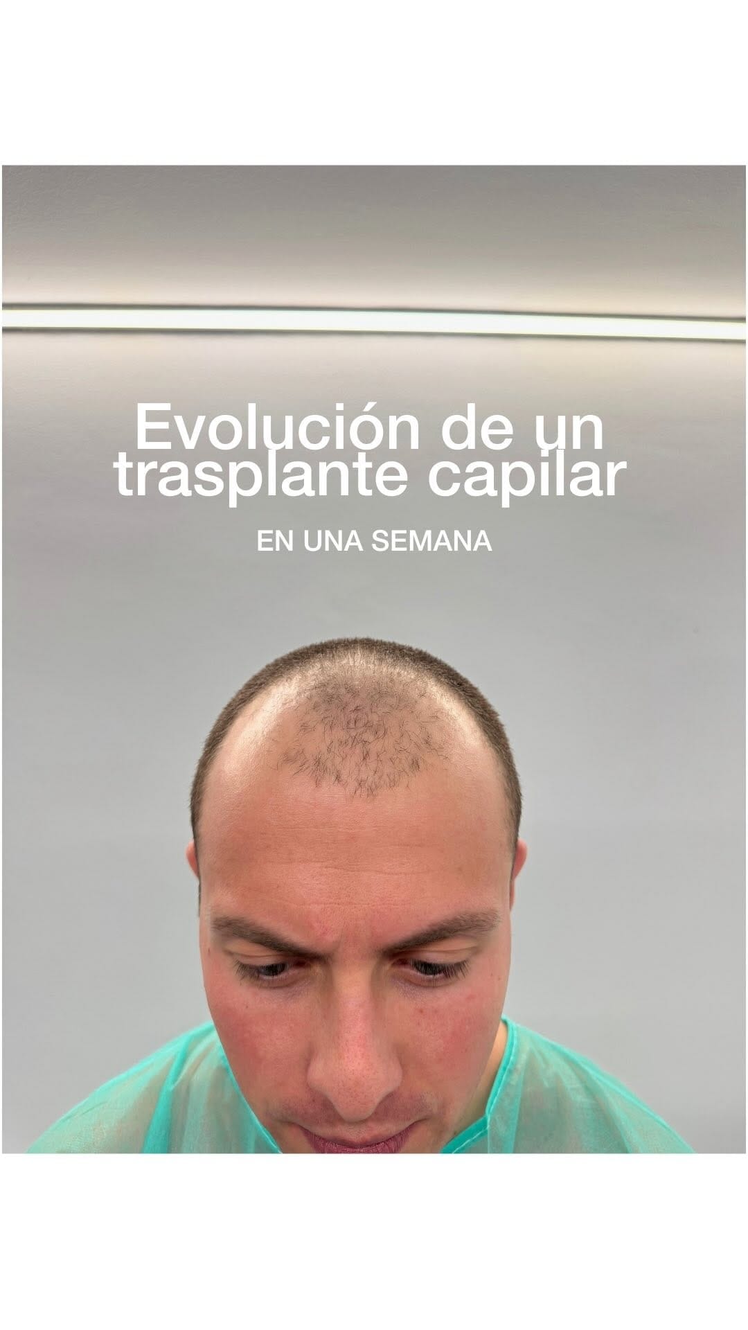 Post 6 by Dr. Ferran Ballescá on Instagram (video)