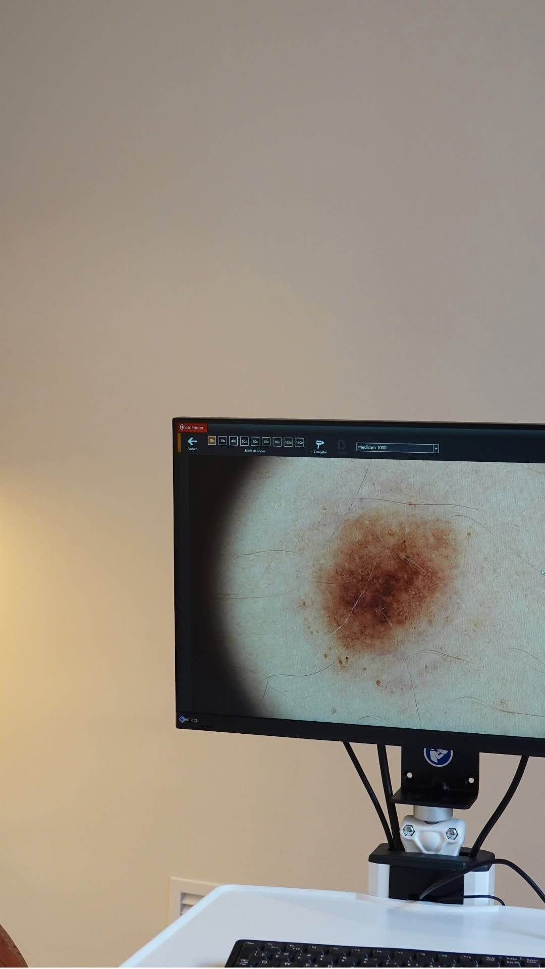 Post 8 by Dr. Ferran Ballescá on Instagram (video)
