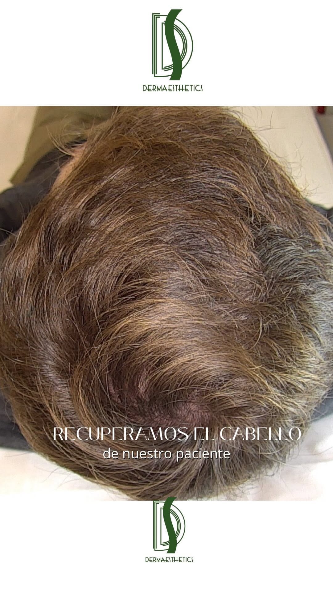 Post 9 by Dr. Ferran Ballescá on Instagram (video)