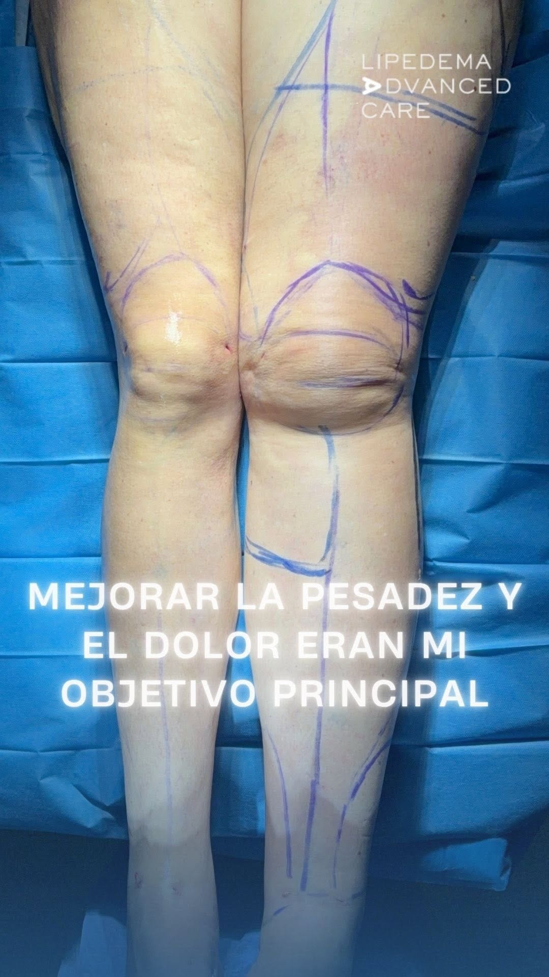 Post 2 by Alexo Carballeira Braña on Instagram (video)