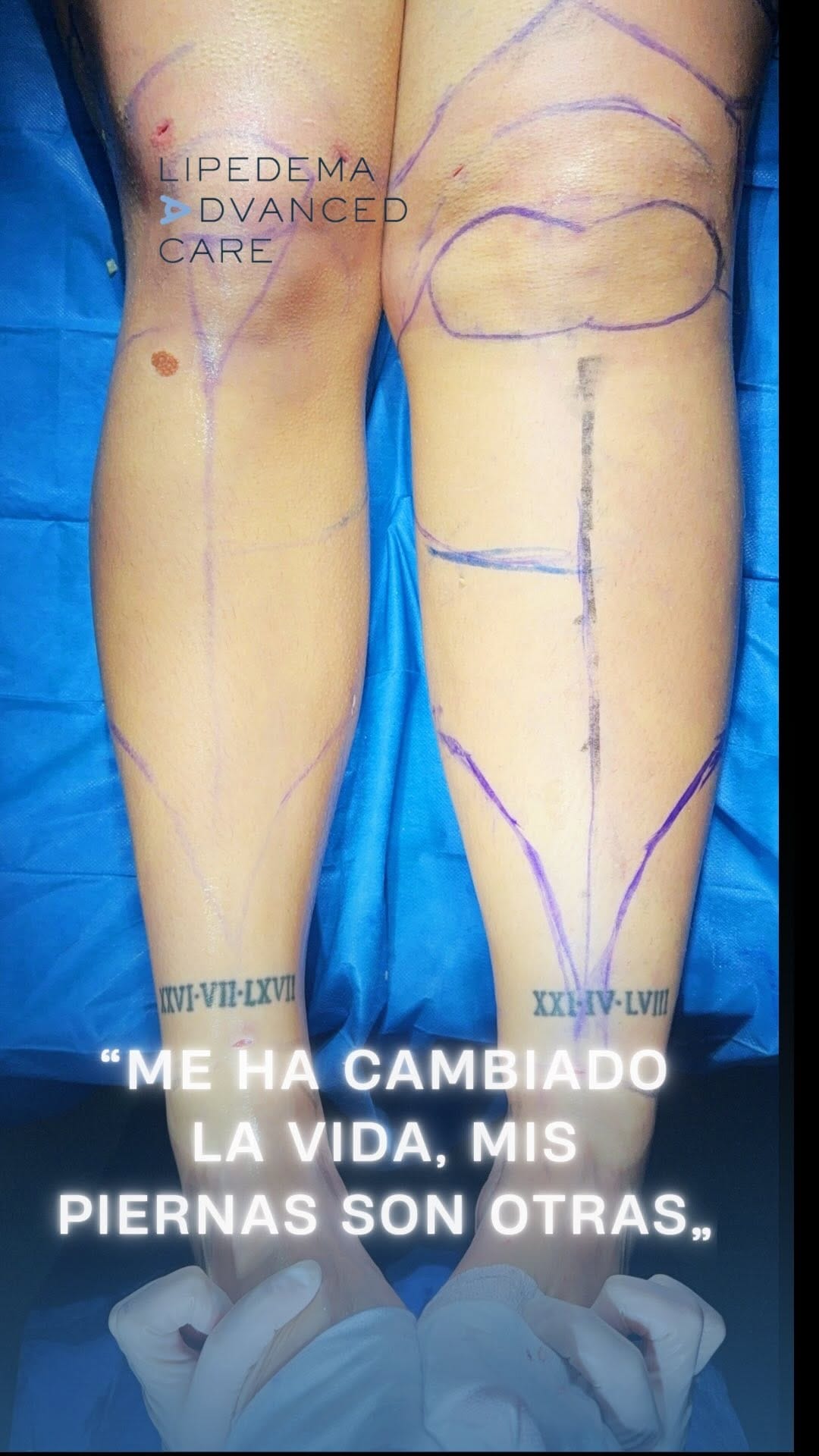 Post 5 by Alexo Carballeira Braña on Instagram (video)