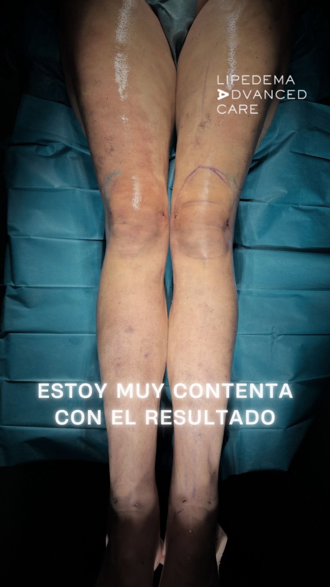 Post 1 by Alexo Carballeira Braña on Instagram (video)
