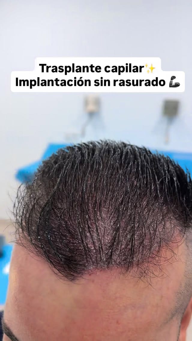 Post 8 by Dra. Daniela Cotellessa on Instagram (video)