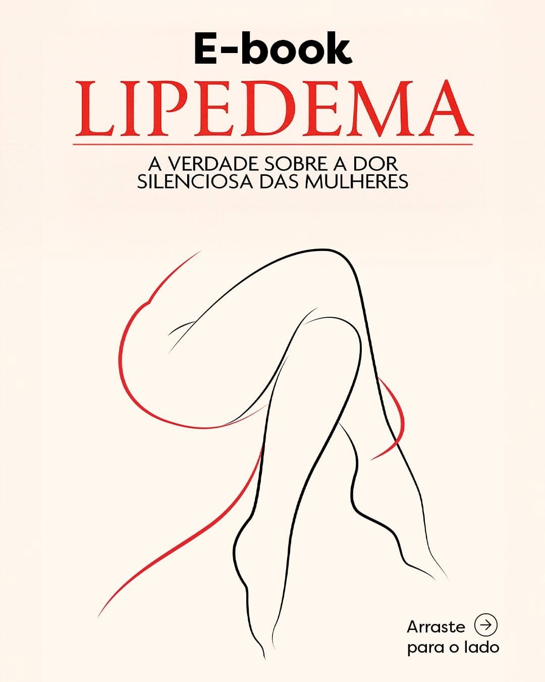 Post 9 by Lipera ® | Instituto Avançado de Lipedema - Toledo/PR on Instagram (carousel)