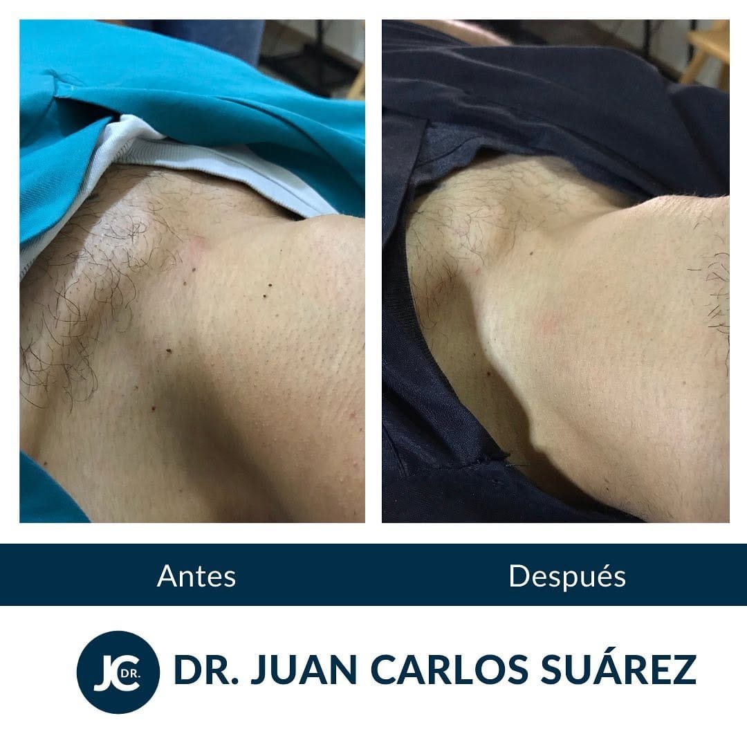 Post 10 by Dr. Juan Carlos Suarez on Instagram (image)