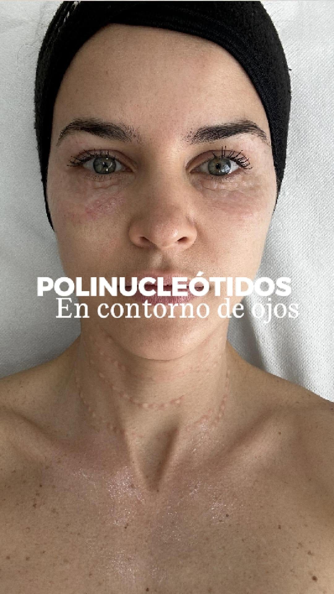 Post 1 by Dra. Perla Meneses R. on Instagram (video)