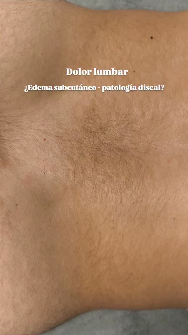 Post 4 by Dr. Borja Núñez de Aysa on Instagram (video)