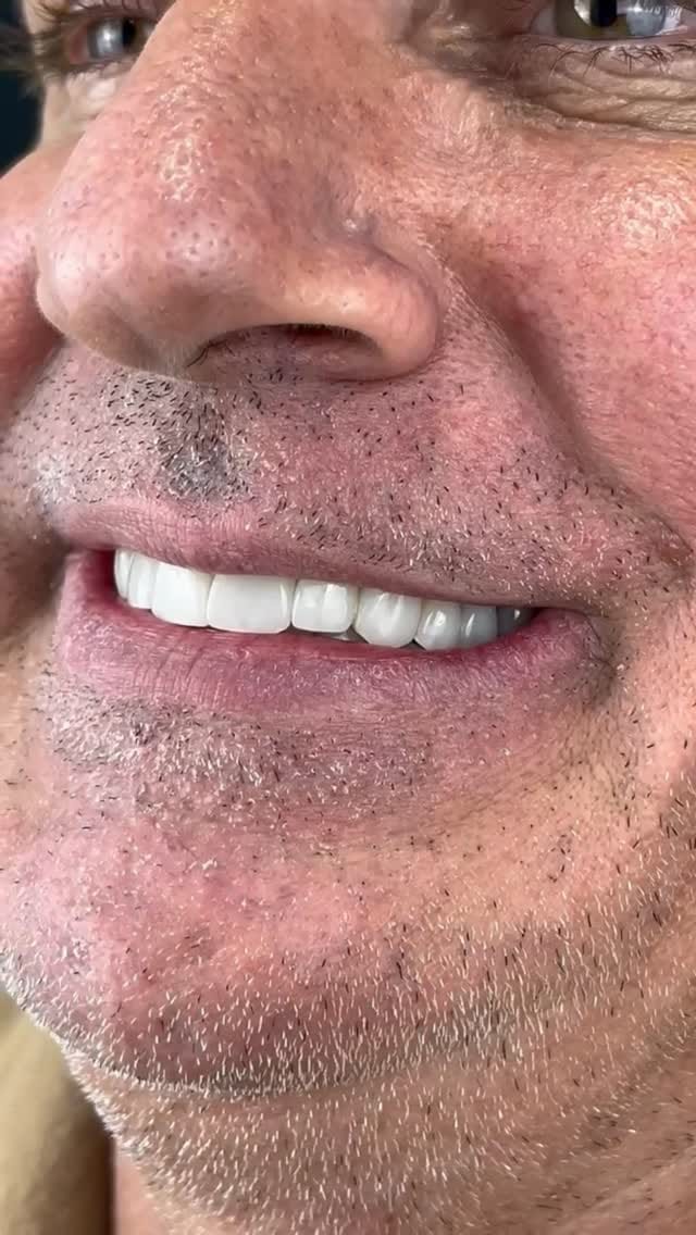 Post 1 by Pedro Massariol | Harmonização Facial on Instagram (video)