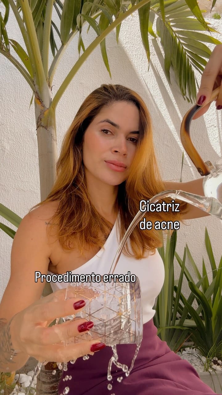 Post 6 by Jully Menezes - Cicatriz de Acne on Instagram (video)