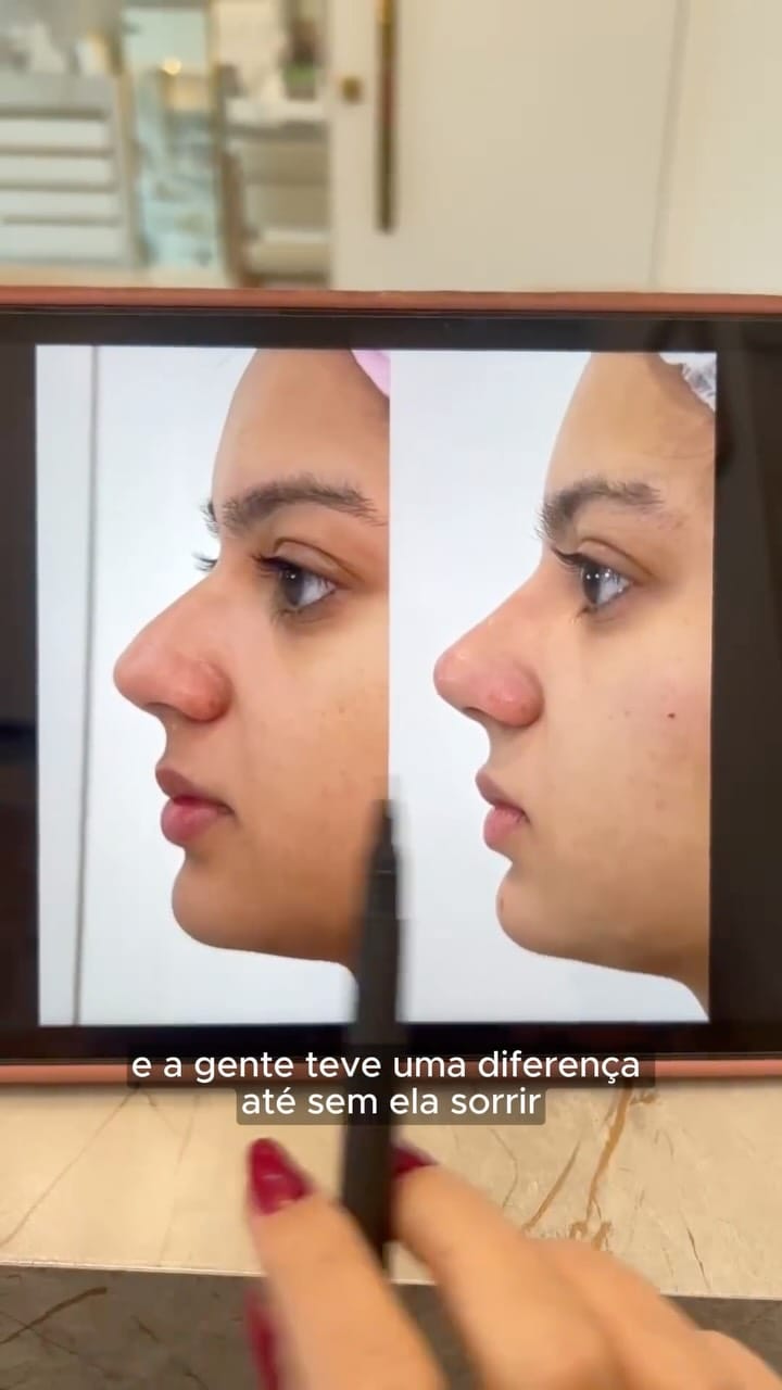 Post 8 by Dra. Natália Caldeira Almeida on Instagram (video)