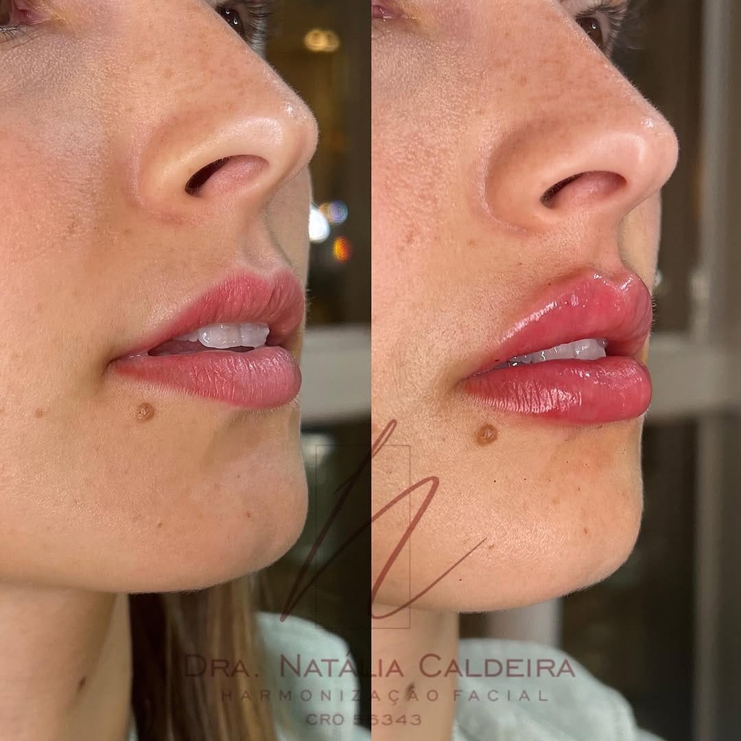 Post 9 by Dra. Natália Caldeira Almeida on Instagram (carousel)