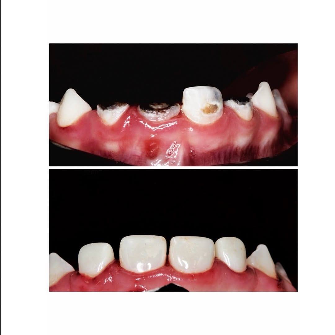 Post 6 by Dr. Igor Pontes | Sedação em odontologia | CRO-Ce 4622 on Instagram (carousel)
