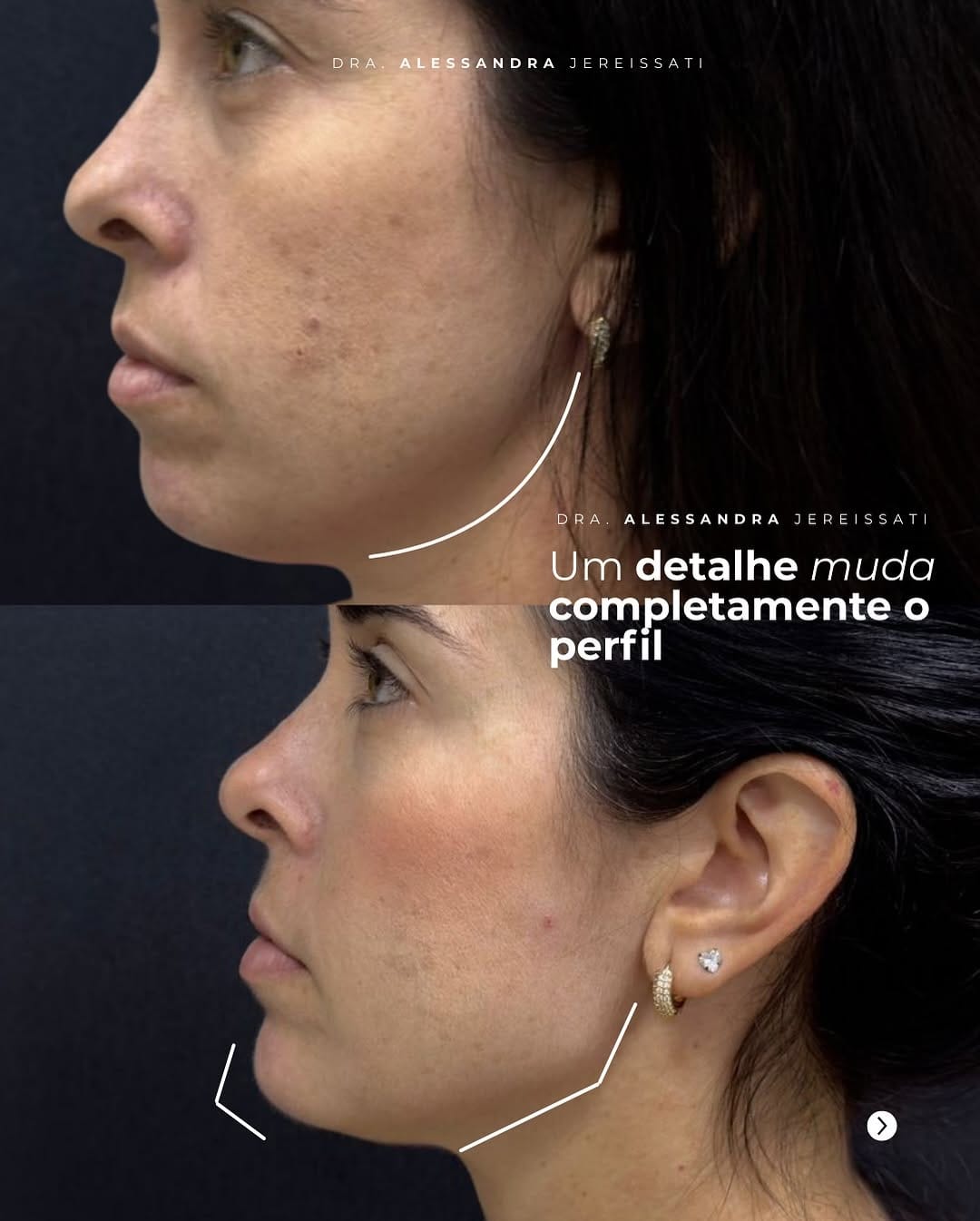 Post 8 by Alessandra Jereissati|Harmonização Facial on Instagram (carousel)