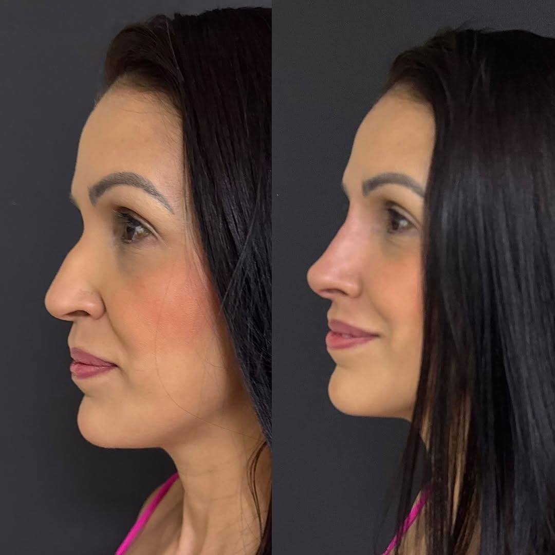 Post 9 by Alessandra Jereissati|Harmonização Facial on Instagram (carousel)