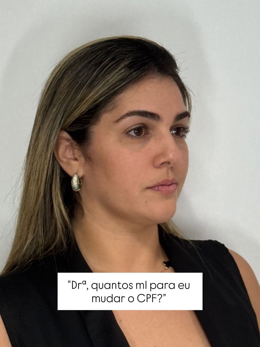 Post 8 by Larissa Actis - Harmonização Facial on Instagram (carousel)