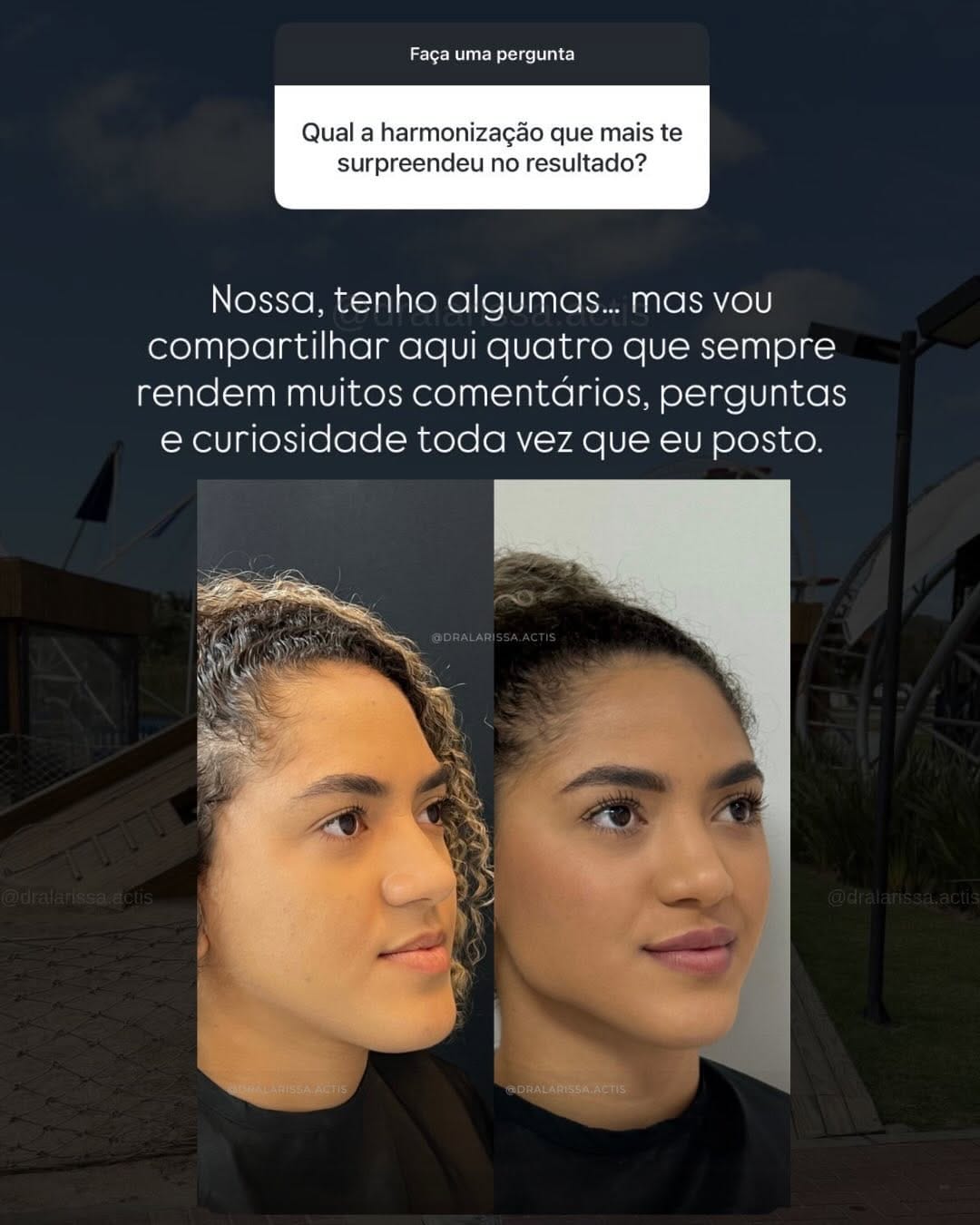 Post 4 by Larissa Actis - Harmonização Facial on Instagram (carousel)