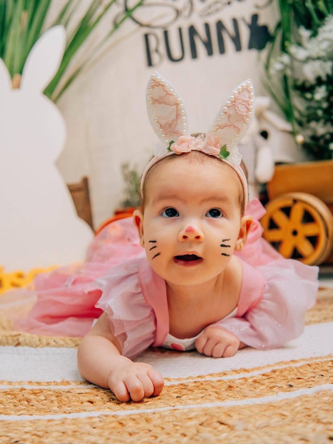 Post 9 by Ava Fair | Harmonização Facial on Instagram (carousel)