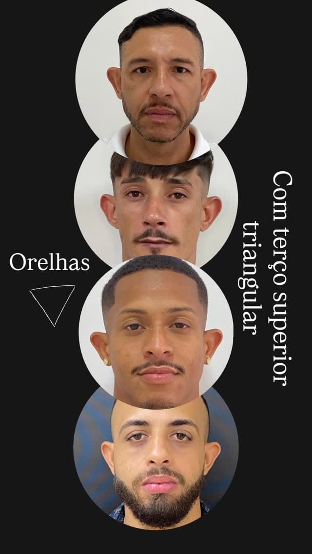 Post 2 by Dra Amanda Borges | OTOMODELAÇÃO🪡👂🏼 on Instagram (video)