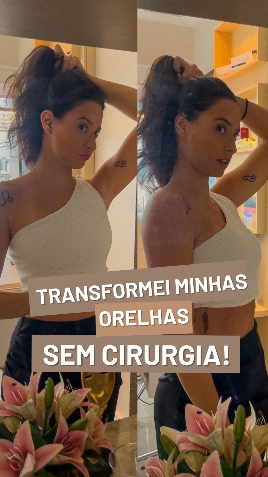 Post 8 by Dra Amanda Borges | OTOMODELAÇÃO🪡👂🏼 on Instagram (video)