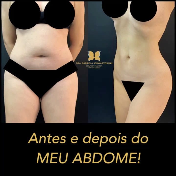 Post 10 by Clinica Dra Gabriela Schwartzmann on Instagram (video)