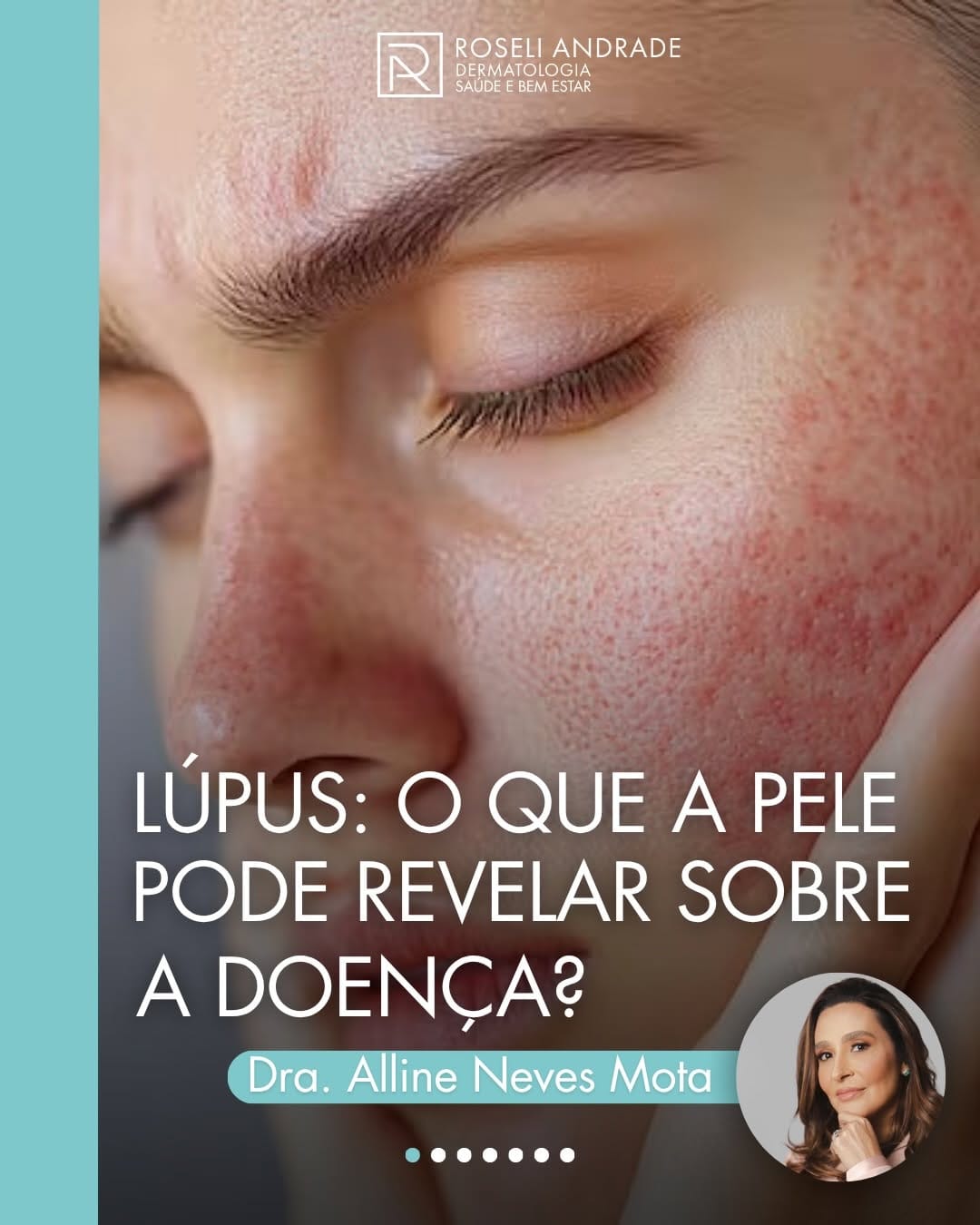 Post 8 by Dra. Alline Neves Mota on Instagram (carousel)