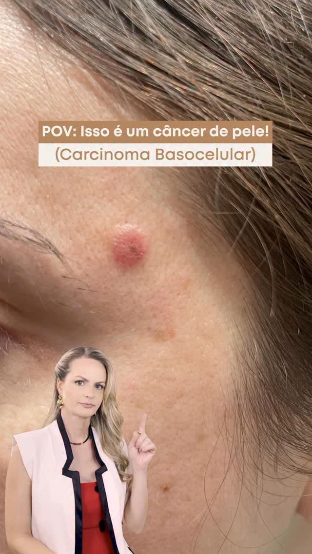 Post 8 by Dra Thaiz  Rigoni Gurtler / Dermatologista on Instagram (video)