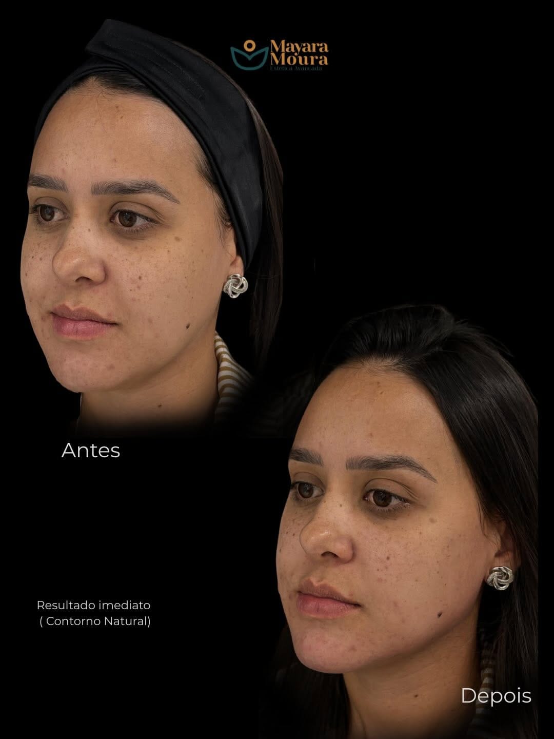 Post 7 by Mayara Moura - Estética Moderna & Personalizada on Instagram (carousel)