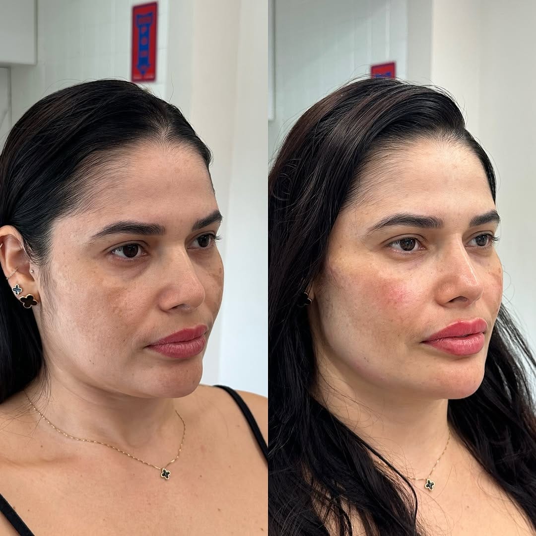 Post 9 by Mayara Moura - Estética Moderna & Personalizada on Instagram (carousel)