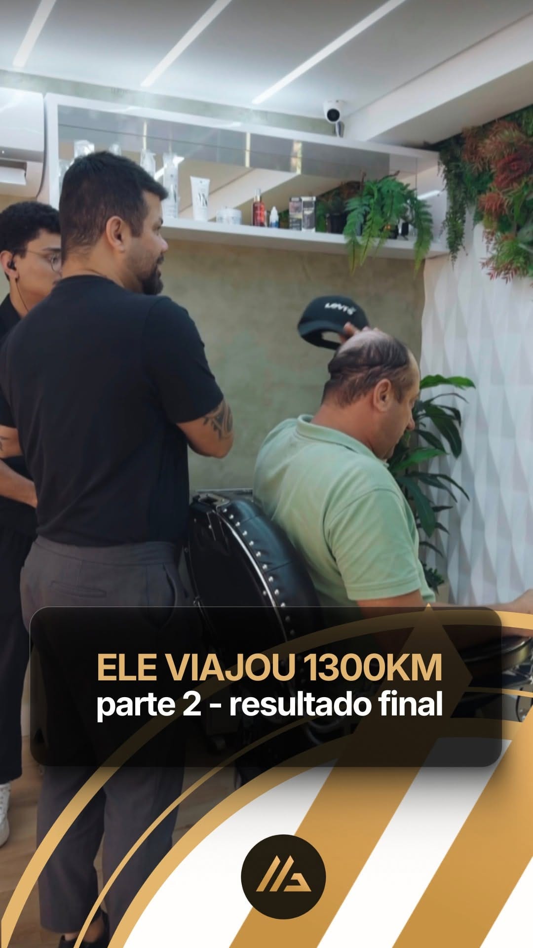 Post 8 by Guto Magalhães | Especialista em Prótese Capilar Masculina on Instagram (video)