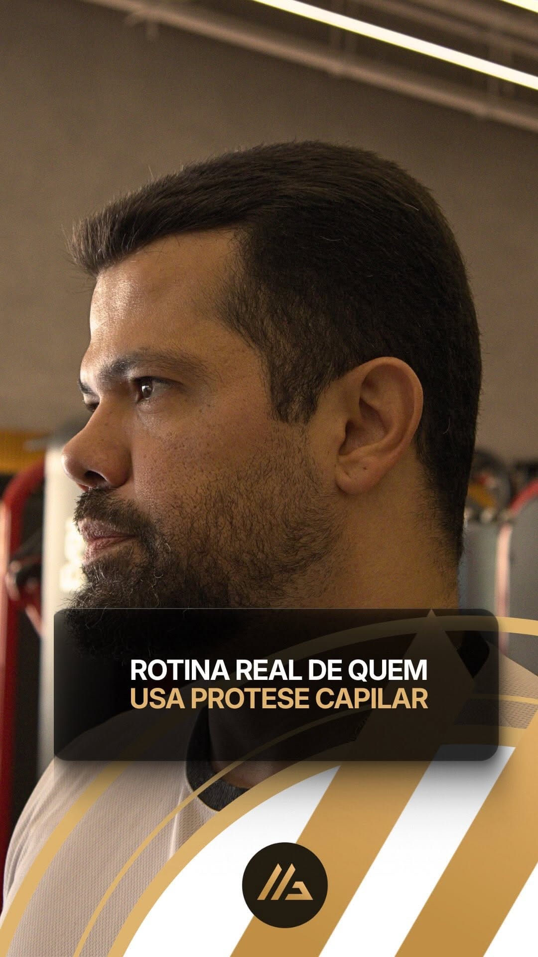 Post 10 by Guto Magalhães | Especialista em Prótese Capilar Masculina on Instagram (video)