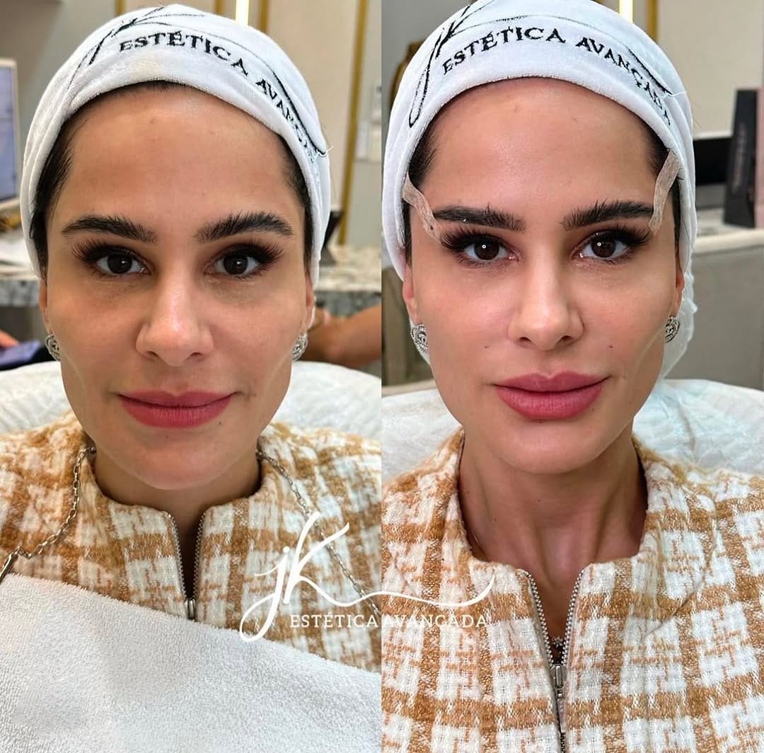 Post 10 by Dr. Pablo Rodrigues | Estética e Rejuvenescimento Facial on Instagram (carousel)